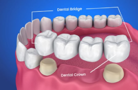 Good Dental Hospital in Chennai