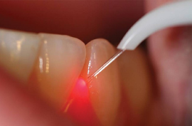 Best Dentist in Chennai